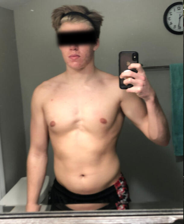 Pale, skinny fat, sickly man w/ a lack of muscle